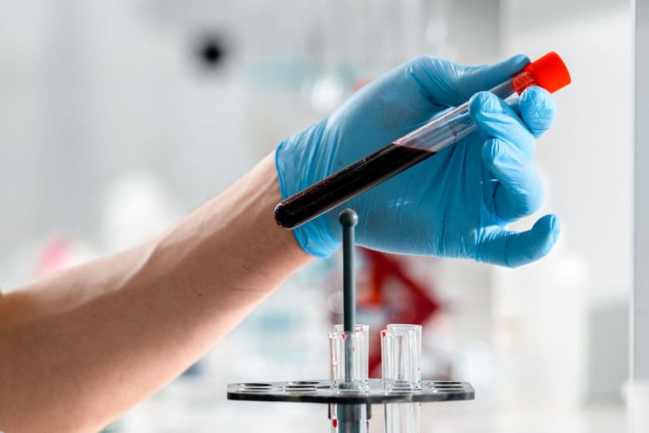 Exame toxicológico CNH 2026: quem precisa fazer e periodicidade